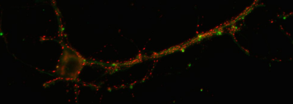 Synapse staining of primary neuron
